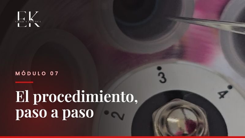 Módulo 7: El procedimiento, paso a paso