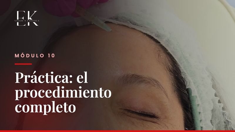 Módulo 10: Práctica, el procedimiento completo